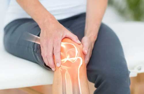 Knee Arthritis