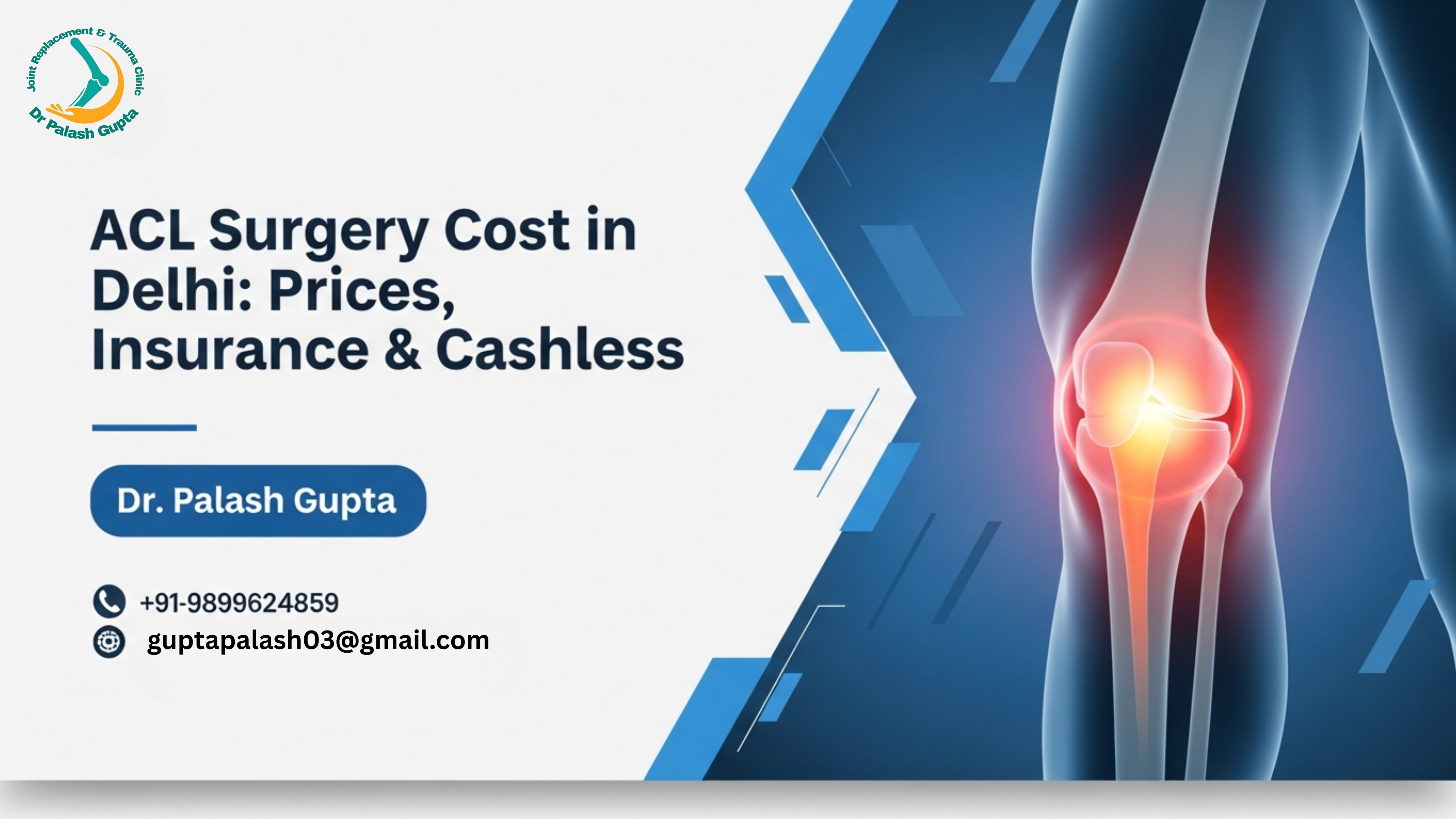 ACL surgery cost in Delhi
