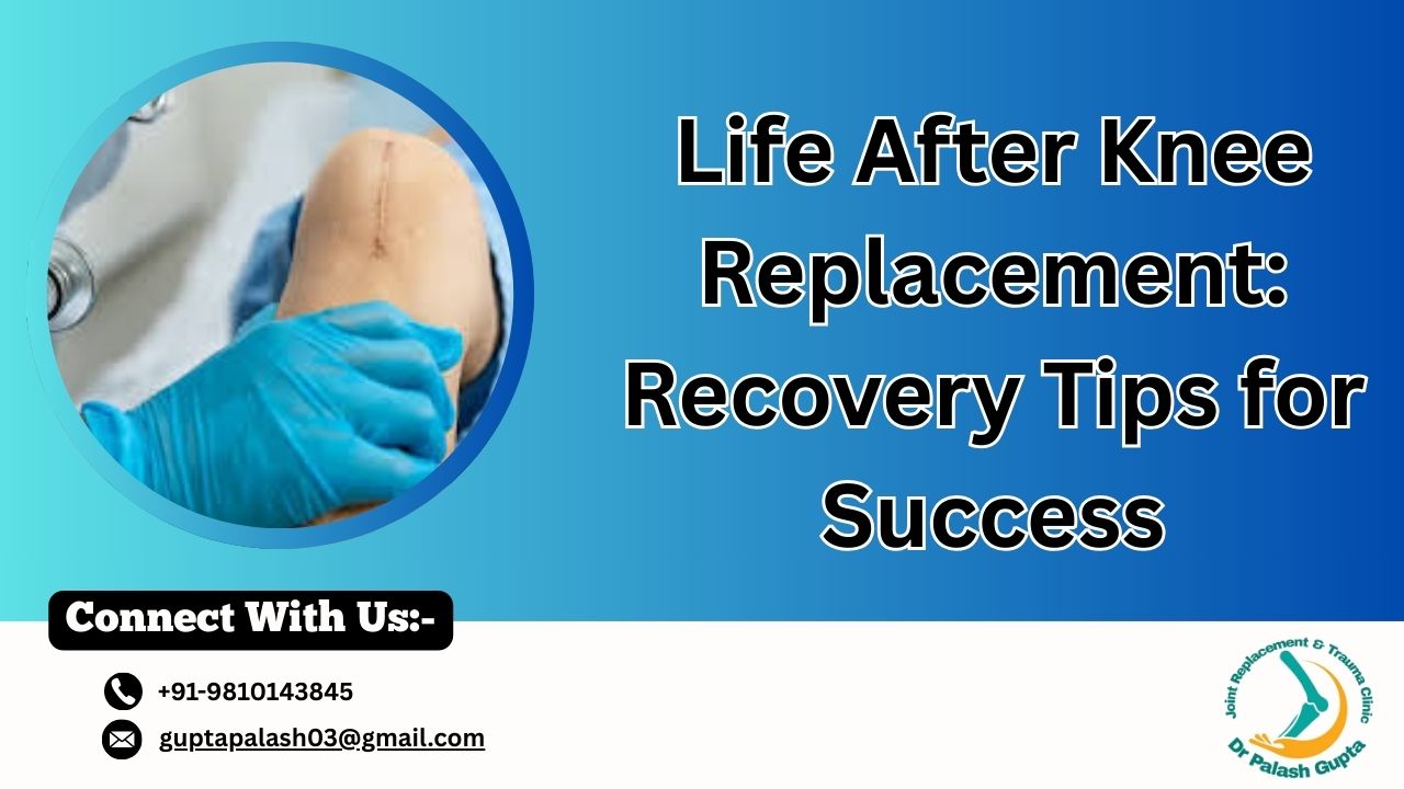 Life After Knee Replacement
